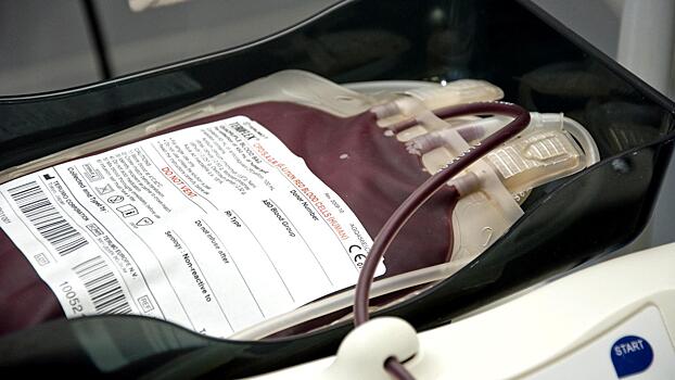 На станцию переливания крови в Вологде приглашают обладателей двух групп