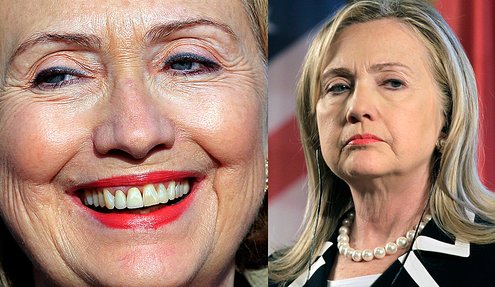 Американский политик Хиллари Клинтон (на фото: до и после операции)