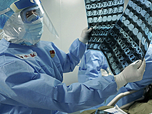 Найдена причина тяжелых осложнений при COVID-19