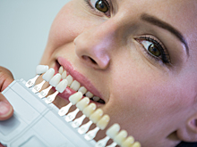 Пусть белое остаётся белым. Стоматолог рассказал, как защитить виниры от черноты