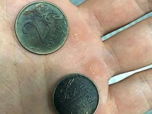 Новороссийские медики вытащили из пищевода малыша три рубля