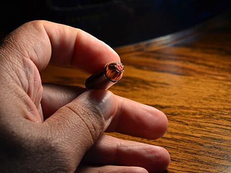 Проживший 17 лет с пулей в глазу россиянин пришел к врачам