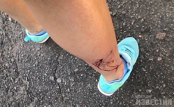 В комитете здравоохранения прокомментировали нападение собак на двух курянок