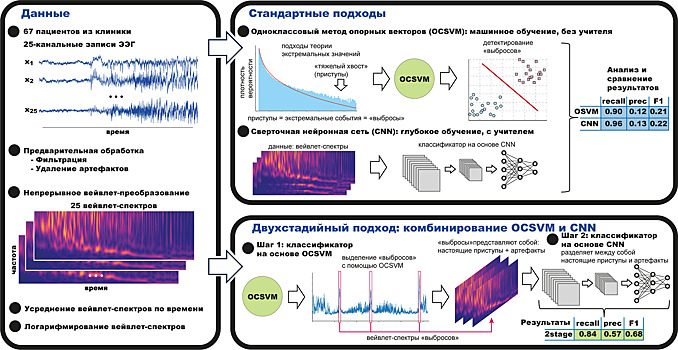 Двухкомпонентный компьютерный алгоритм с высокой точностью выявит эпилепсию