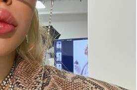 Инстасамка сядет в инвалидное кресло ради "пластики"