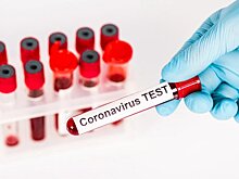 14 главных вопросов про тест на коронавирус