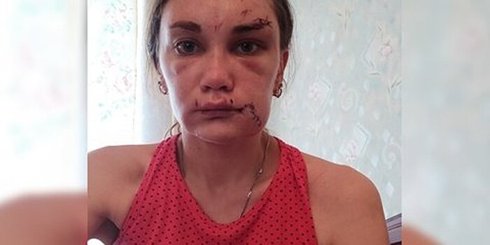 В Госдуме готовы помочь пострадавшей от рук экс-супруга женщине из Урюпинска