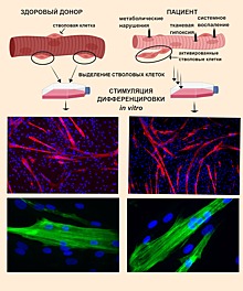 Мышечную ткань у пациентов с сердечной недостаточностью можно восстановить
