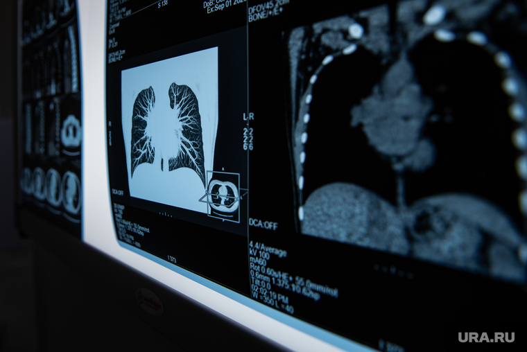 Власти ХМАО приобретут для сургутской больницы дорогостоящий рентген-аппарат