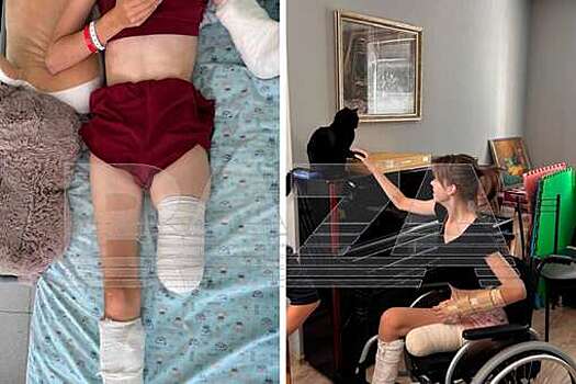 На Калужском шоссе пьяный водитель оторвал ногу девочке и даже не извинился