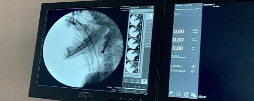 Нейрохирурги Нижнего Тагила спасли двух пациентов с тяжелейшими переломами позвоночника