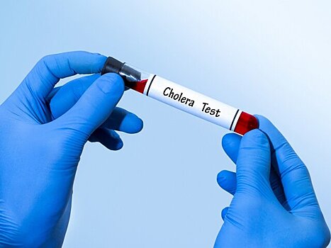 Вспышка холеры зафиксирована среди ВСУ в Херсоне