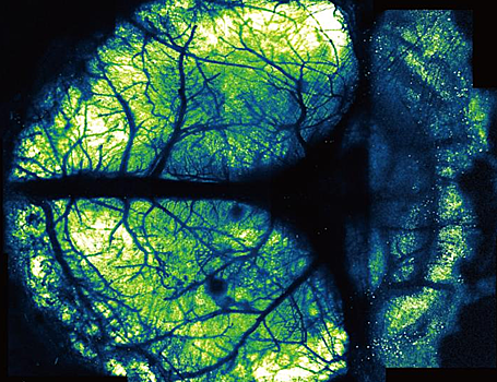 Разработан улучшенный метод визуализации мозга