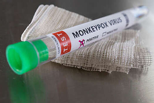 Роспотребнадзор: все регионы РФ имеют возможность проводить тестирование на оспу обезьян