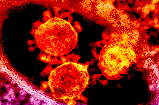 PLoS Pathogens: у летучих мышей из России нашли новый коронавирус, способный заражать клетки человека