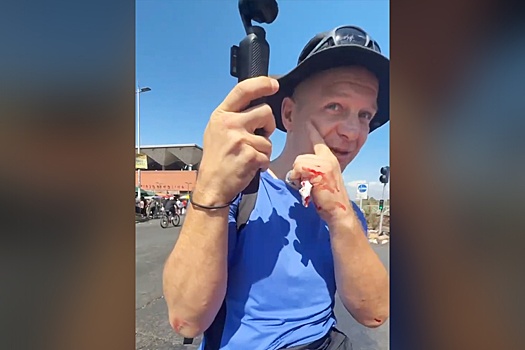 В столице Чили Сантьяго неизвестный напал на съемочную группу РЕН ТВ