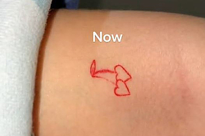Девушка сделала тату на курорте и получила неожиданный результат
