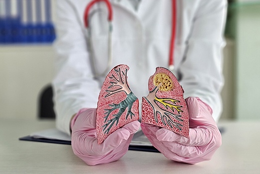 Эксперты обсуждают способы уменьшить онкориски у заядлых курильщиков