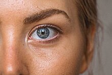 Кардиолог раскрыл способ распознать высокий холестерин по глазам