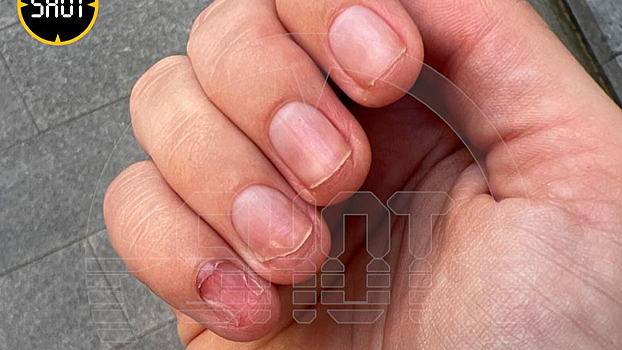 Девушка лишилась ногтей после похода в салон в центре Москвы