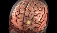Ученые нашли способ омолодить мозг на десять лет