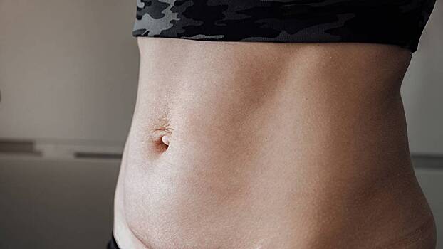 «Органы выпячиваются вперед и начинают давить»: чем опасен диастаз