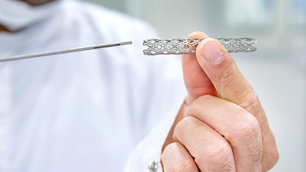 Как меняется жизнь после установки стента в сосуды