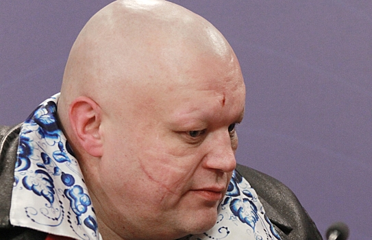 Барецкий рассказал о проблемах с деньгами у Пугачевой