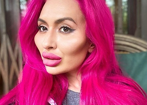 Накачавшая «скулы-кулаки» фрик-дива увеличила бюст и срезала двойной подбородок