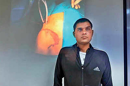 Жертва аварии с выпавшим легким 10 часов просил врачей ему помочь и выжил