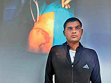 Жертва аварии с выпавшим легким 10 часов просил врачей ему помочь и выжил