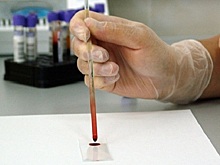 В России создадут антибиотик из человеческой крови