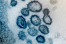 Раскрыта реальная опасность коронавируса для мозга