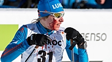 Российской лыжнице Медведевой, получившей рассечение во время гонки на ЧМ, наложили швы