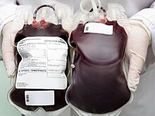 Старческое слабоумие будут лечить молодой кровью