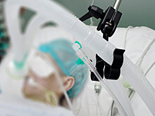 РАН: смертность пациентов с COVID-19 на аппаратах ИВЛ составляет почти 70%
