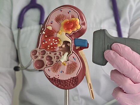 Нефролог Артюхина перечислила первые признаки почечной недостаточности