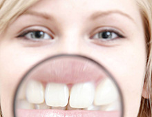 Врачебные тайны: как стоматологи сохраняют здоровье собственных зубов