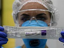 У жительницы Магадана подозревают коронавирус