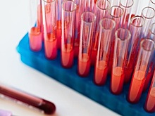 Назван секрет избежать тромбоза после коронавируса