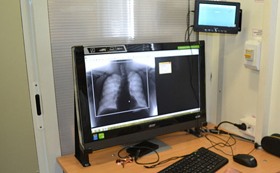 Пятеро больных туберкулезом выявлено в Доволенском районе в 2019 году