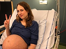 Беременная тройней женщина шокировала соцсети