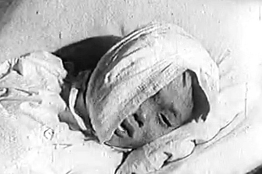 Хроника исцеления 65 лет спустя: Как советские медики спасли обгоревшего китайского малыша