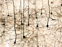 Учёные изобрели способ восстановления нервных клеток