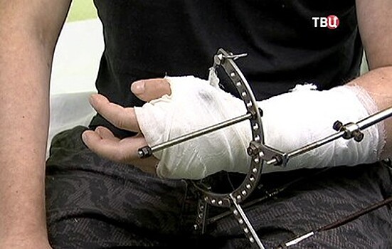 Московские хирурги спасли руку пациента от ампутации