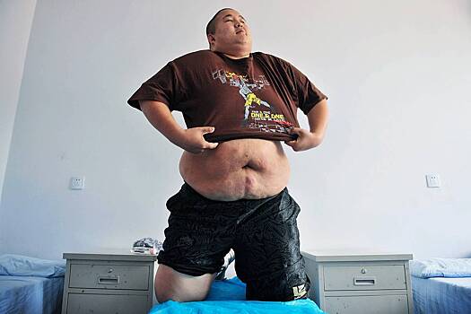 Врач оценила вероятность набрать вес из-за стресса