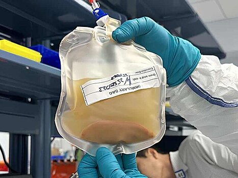 Ученые из США начали выращивать мини-печень внутри организма пациента