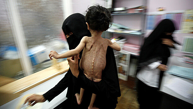 Миллионы детей в Йемене оказались на грани голодной смерти