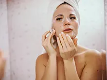 Врач рассказал, как справиться с постакне