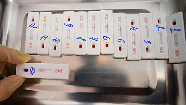 Роспотребнадзор правит правила въезда ВИЧ-инфицированных в РФ